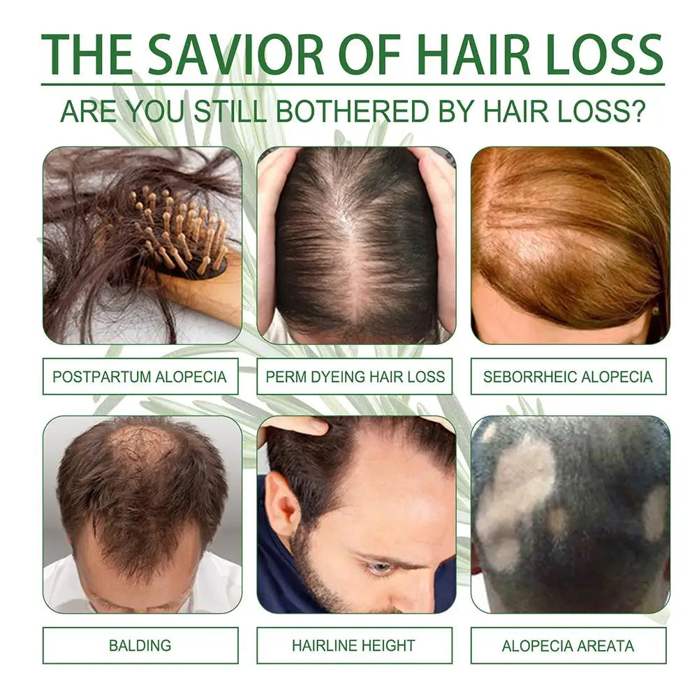 Rosemary Oil Hair Growth Essential Coconut Oil Improve Hair Loss And Nourishes Strengthen Hair Roots Scalp Treatment Hair Care